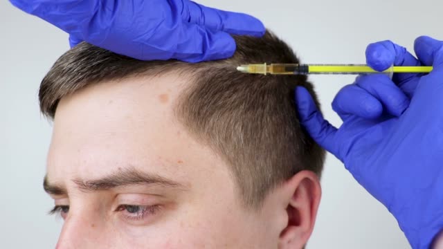Discover the Benefits of Hair Transplant London Services