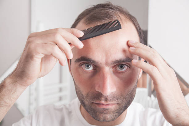 How Much Does Hair Transplant Cost in Istanbul Medical Tourism?